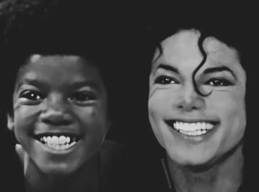 Michael Jackson und Lupus